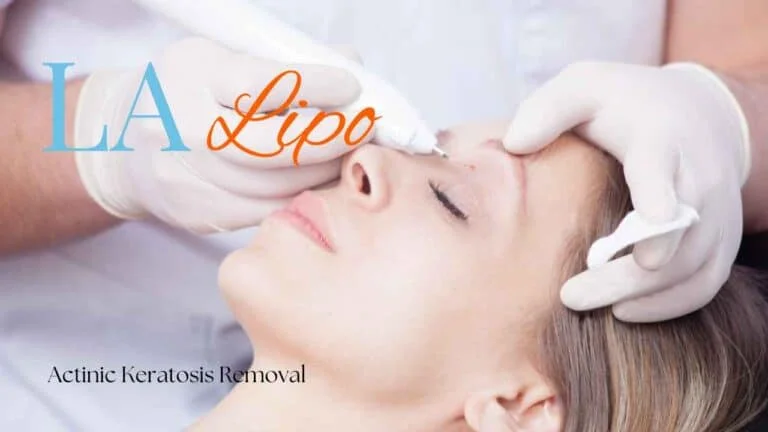 Woman receiving Actinic Keratosis Removal Treatment Southampton