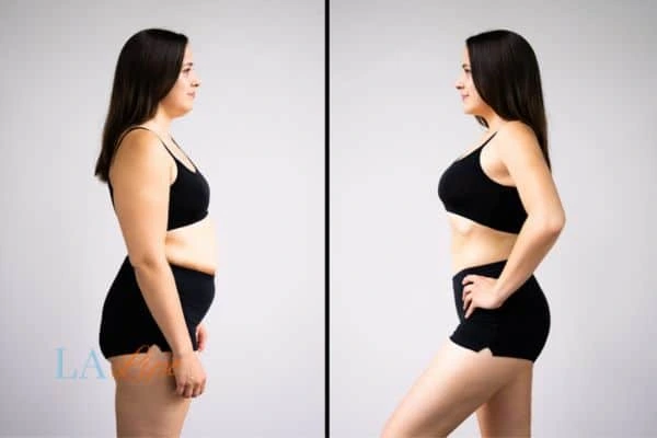 LA-EMS Body Sculpting Southampton results before and after of womans results on body toning.