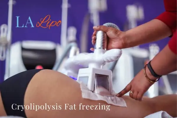 women getting fat freezing Southampton
