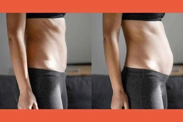 LA-EMS Body Sculpting results Southampton