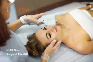 Woman having Hi-Fu to reduce wrinkles Southampton.