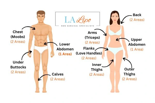 LA LIPO Cryolipolysis Areas Southampton