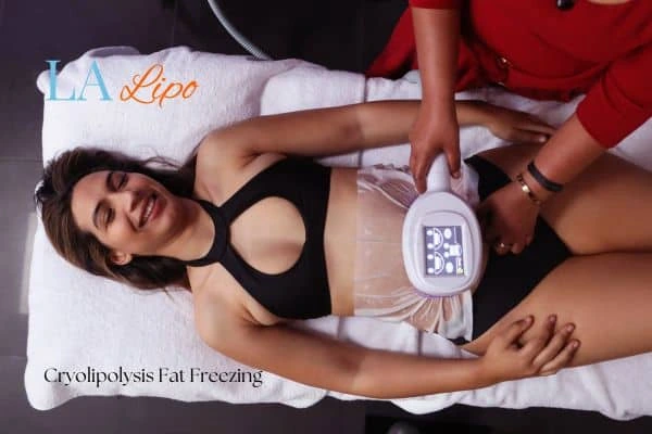 woman getting cryolipolysis Southampton