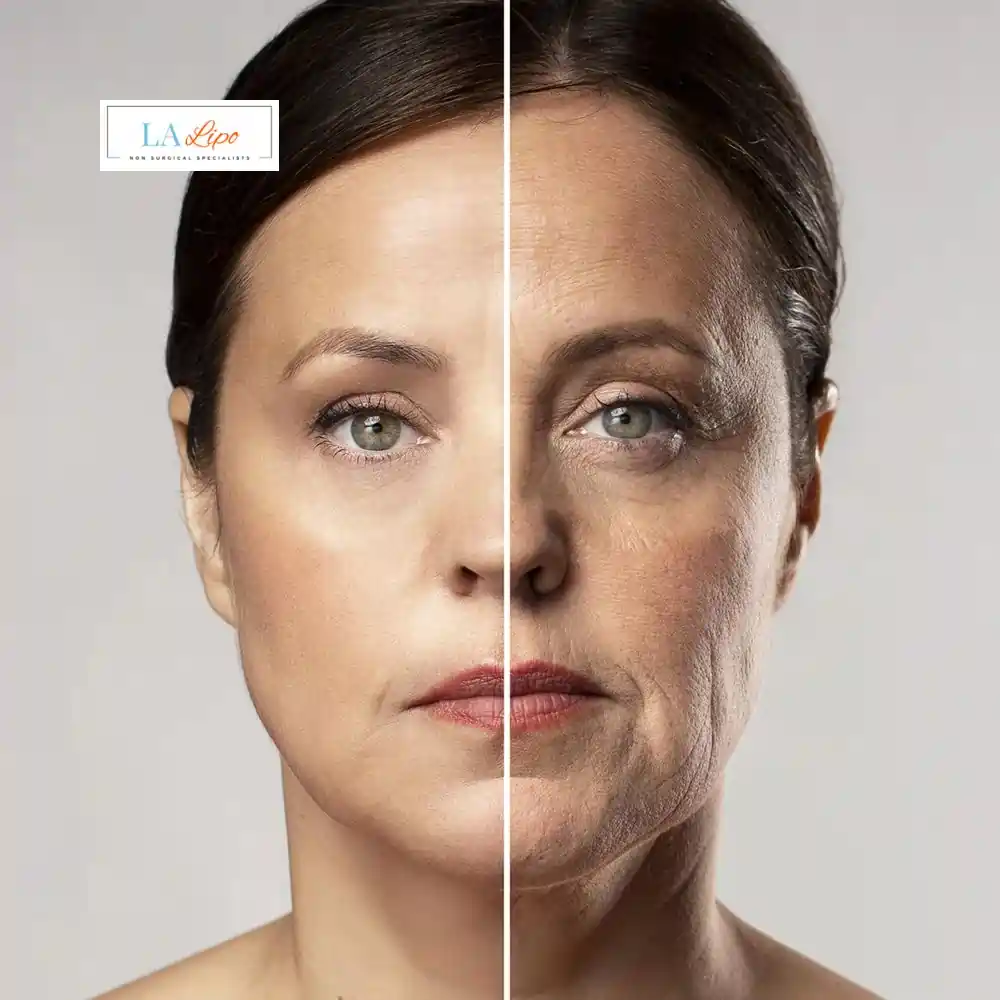 How Can You Tell If Non-Surgical Skin Tightening Is Right for You Southampton?