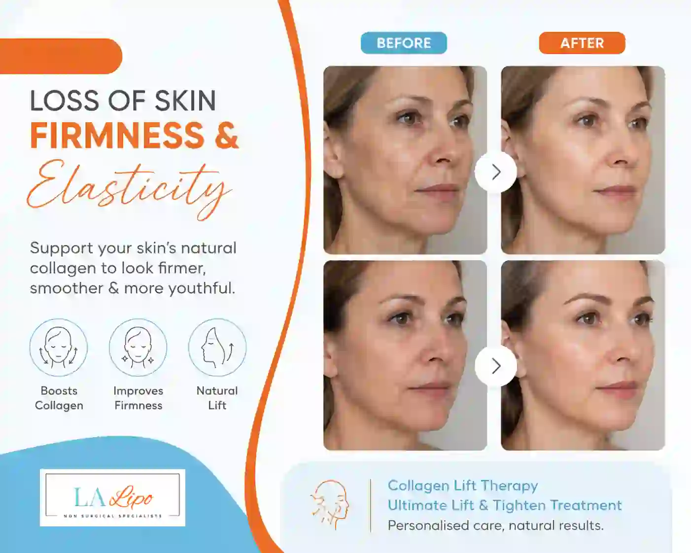 Sign #7: Loss of Skin Firmness and Elasticity Southampton