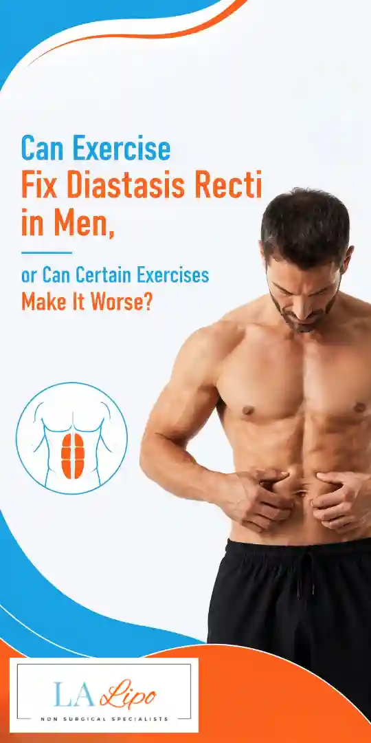 Can Exercise Fix Diastasis Recti in Men, or Can Certain Exercises Make It Worse Southampton?